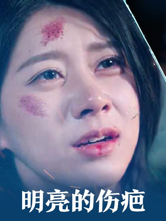 明亮的伤疤封面